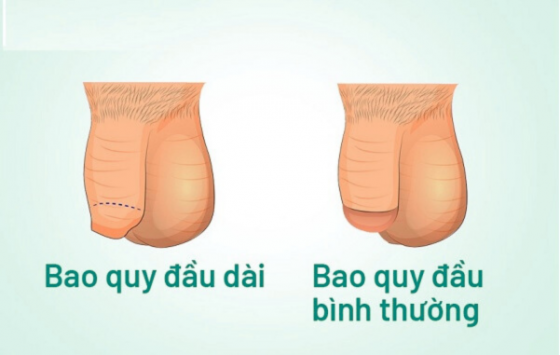 dai-bqd.png