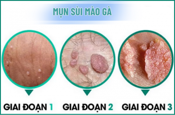 chua-benh-hieu-qua (34).png