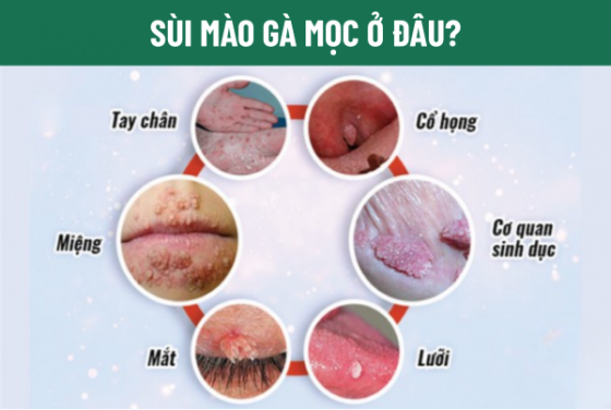 chua-benh-hieu-qua (48).png