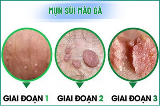 chua-benh-hieu-qua.png