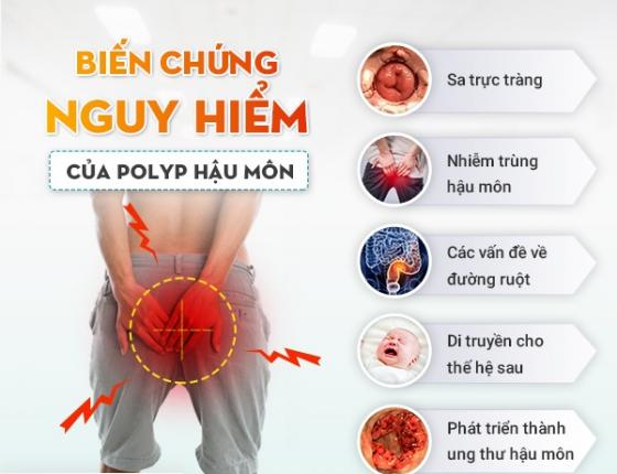 poly-hau-mon-bien-chung.jpg