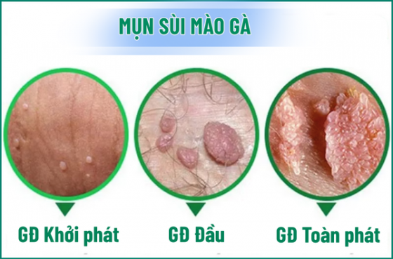 chua-benh-hieu-qua (85).png