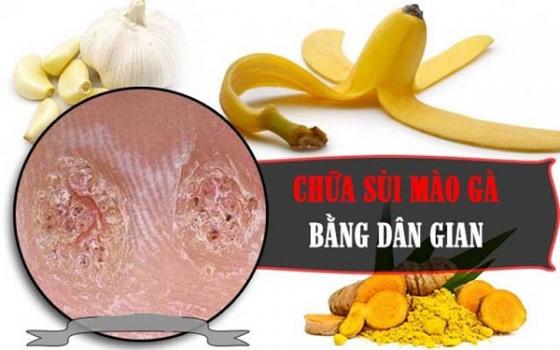 chua-sui-mao-ga-bang-meo-dan-gian.jpg