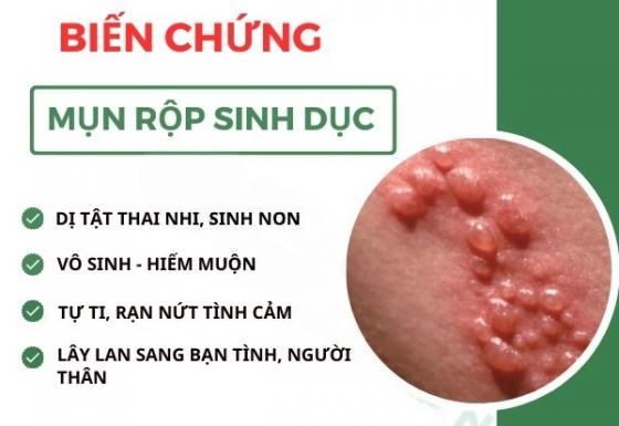 mun-rop-bien-chung.jpg