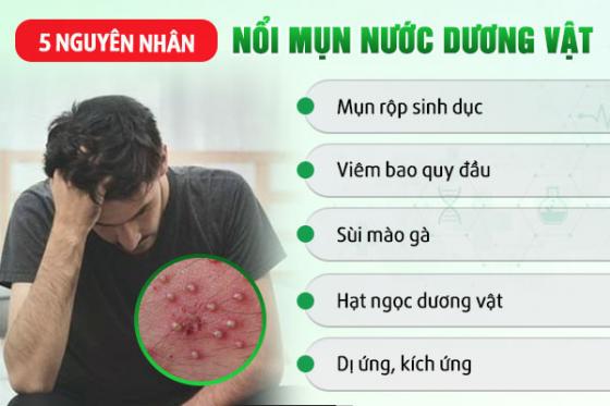 1774345934726386.jpg mun-nuoc.jpg